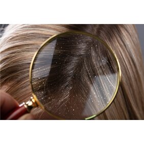 Ako bojovať s lupinami?